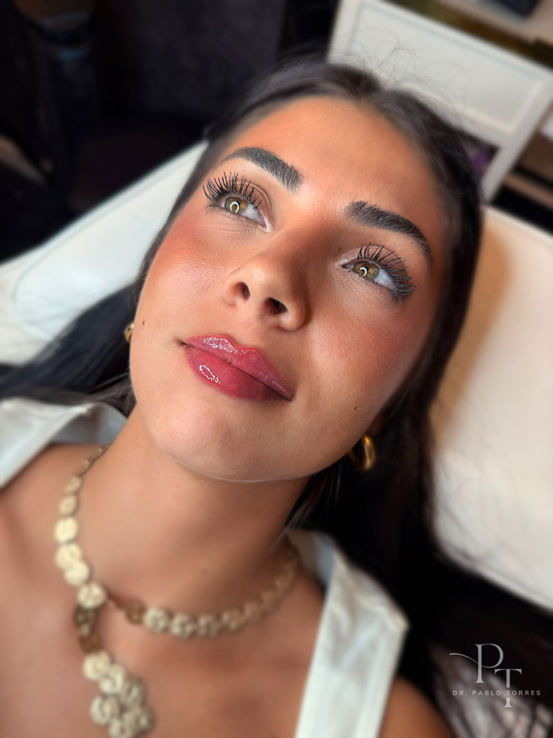 Labios